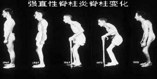 上海强直医院